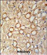 CRB2 Antibody in Immunohistochemistry (Paraffin) (IHC (P))