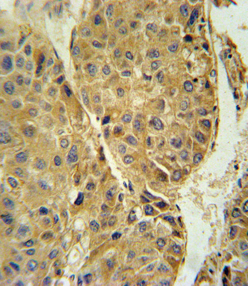 beta-3 Tubulin Antibody in Immunohistochemistry (Paraffin) (IHC (P))