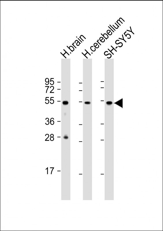 beta-3 Tubulin Antibody in Western Blot (WB)