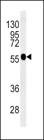 beta-3 Tubulin Antibody in Western Blot (WB)