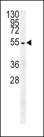 beta-3 Tubulin Antibody in Western Blot (WB)