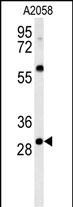 GSTO2 Antibody in Western Blot (WB)