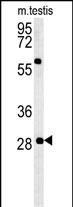 GSTO2 Antibody in Western Blot (WB)