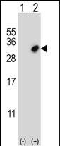 GSTO2 Antibody in Western Blot (WB)