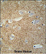 beta Synuclein Antibody in Immunohistochemistry (Paraffin) (IHC (P))