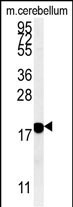 beta Synuclein Antibody in Western Blot (WB)