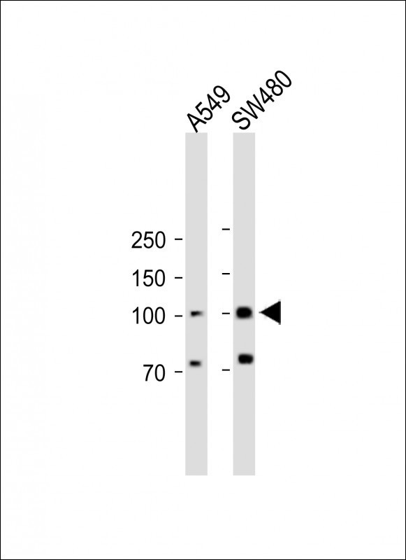 RASGRP1 Antibody in Western Blot (WB)