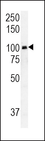 RASGRP1 Antibody in Western Blot (WB)