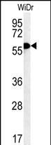 TANK Antibody in Western Blot (WB)