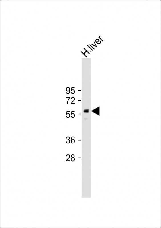 PPAR gamma Antibody in Western Blot (WB)