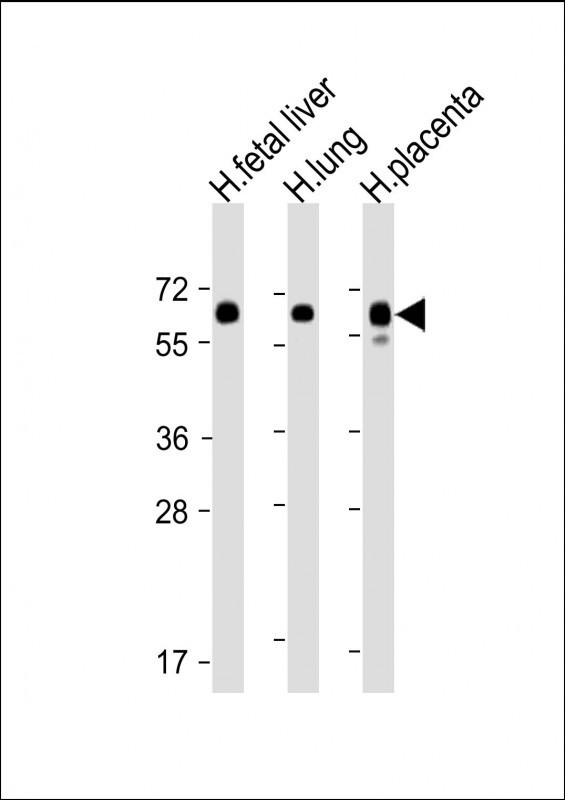 PPAR gamma Antibody in Western Blot (WB)