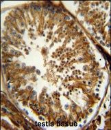 PAOX Antibody in Immunohistochemistry (Paraffin) (IHC (P))