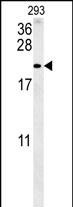 TAC1 C-terminal Peptide Antibody in Western Blot (WB)