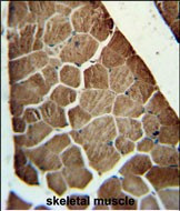 ADSSL1 Antibody in Immunohistochemistry (Paraffin) (IHC (P))