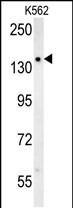 KCC2 Antibody in Western Blot (WB)