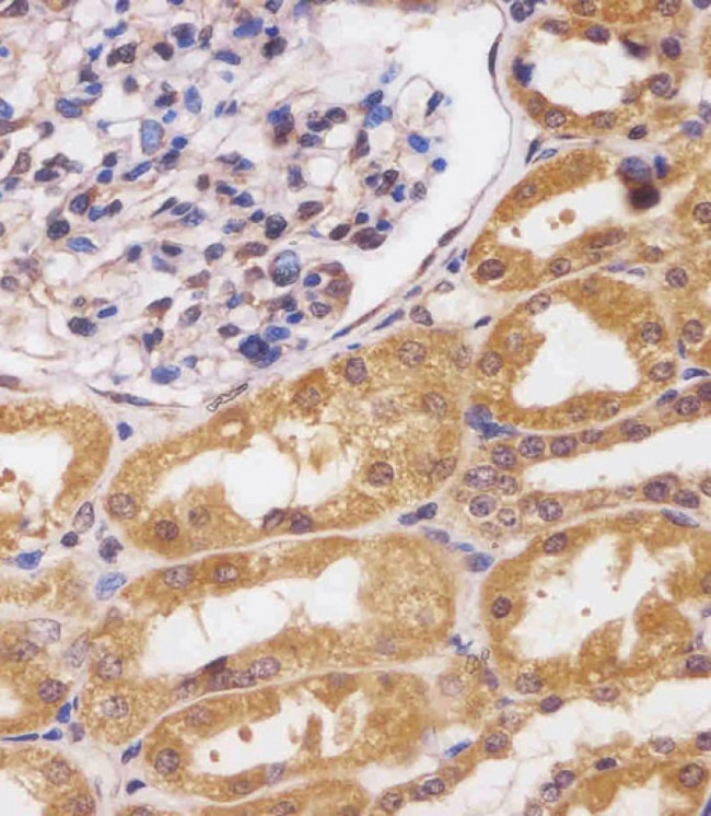 CUX1 Antibody in Immunohistochemistry (Paraffin) (IHC (P))