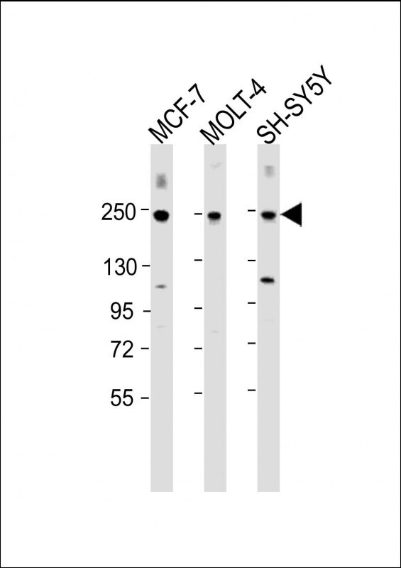 CUX1 Antibody in Western Blot (WB)