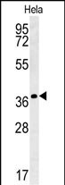 IL24 Antibody in Western Blot (WB)