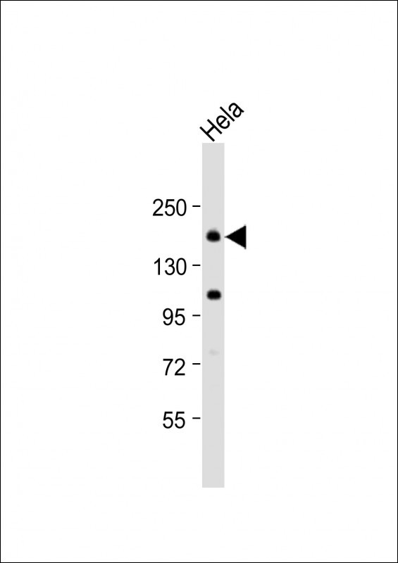 Clathrin Heavy Chain Antibody in Western Blot (WB)