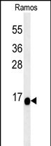 C1orf186 Antibody in Western Blot (WB)