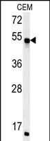 FKBP8 Antibody in Western Blot (WB)