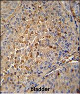 EB1 Antibody in Immunohistochemistry (Paraffin) (IHC (P))