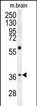 EB1 Antibody in Western Blot (WB)