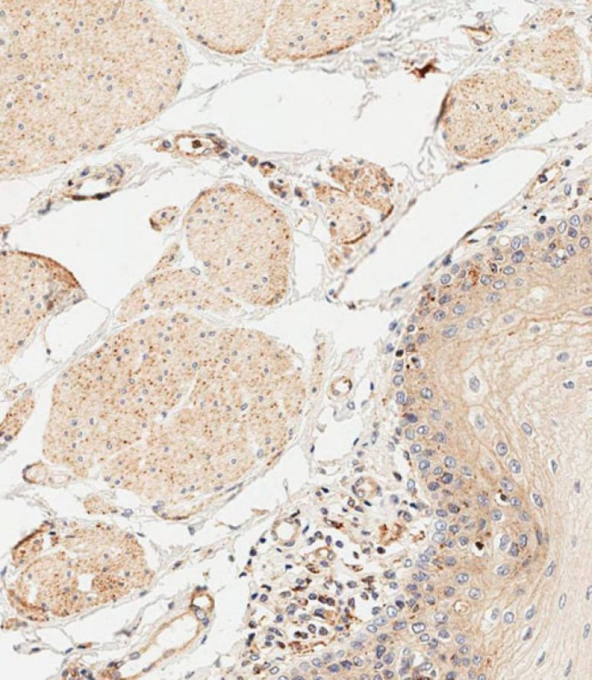 IL-1 alpha Antibody in Immunohistochemistry (Paraffin) (IHC (P))