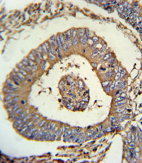 Calreticulin Antibody in Immunohistochemistry (Paraffin) (IHC (P))