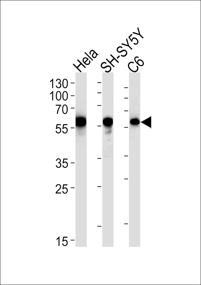 Calreticulin Antibody in Western Blot (WB)