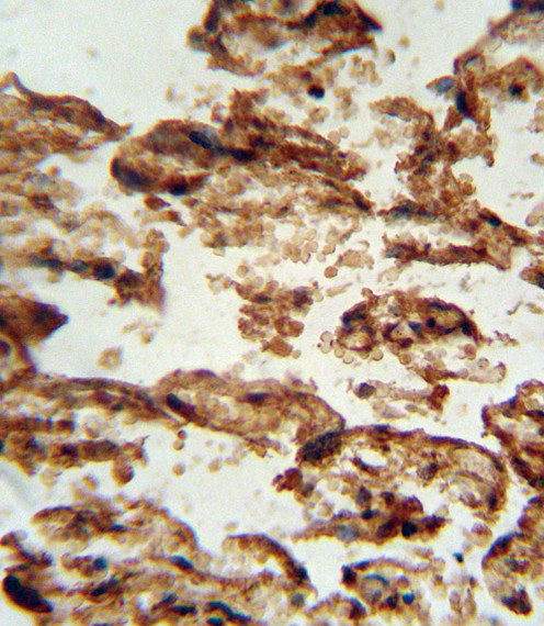 IGFBP4 Antibody in Immunohistochemistry (Paraffin) (IHC (P))