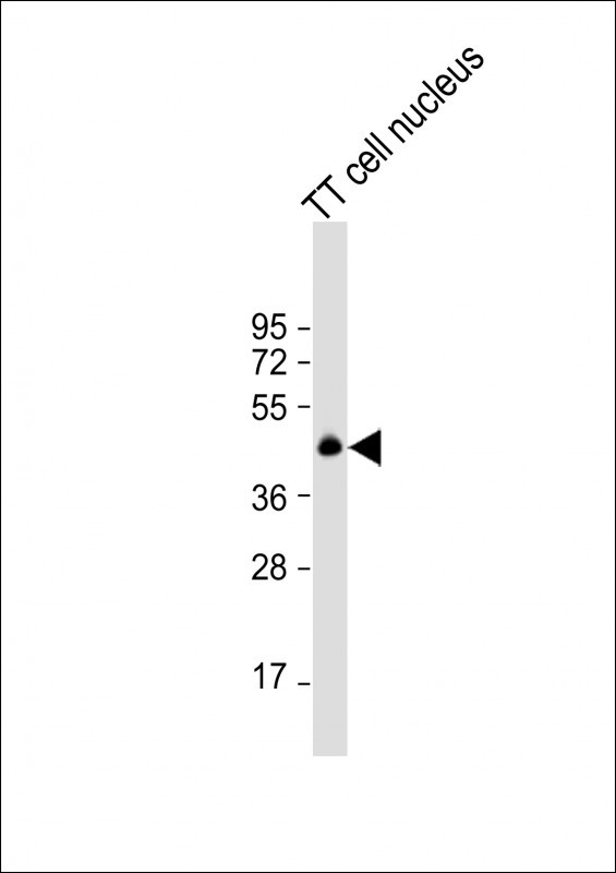 Nkx2.1 Antibody in Western Blot (WB)