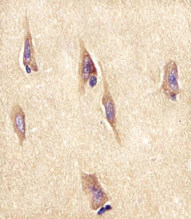 NPTX1 Antibody in Immunohistochemistry (Paraffin) (IHC (P))