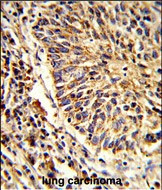 ADAM9 Antibody in Immunohistochemistry (Paraffin) (IHC (P))