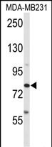 ADAM9 Antibody in Western Blot (WB)