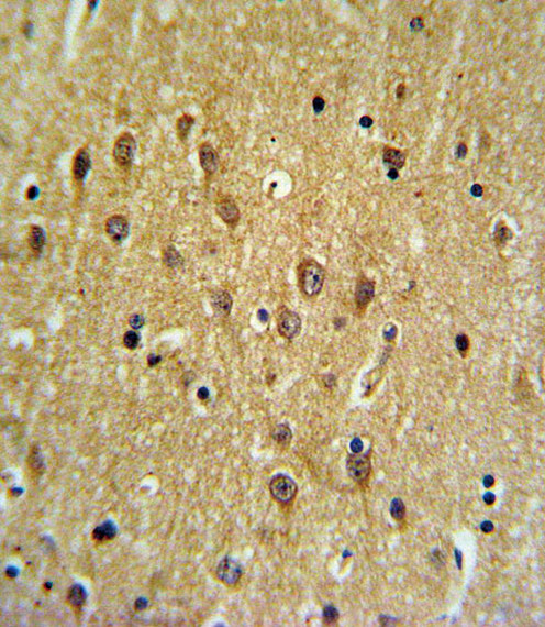 EHD3 Antibody in Immunohistochemistry (Paraffin) (IHC (P))