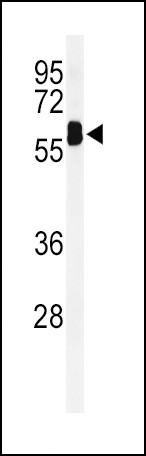 EHD3 Antibody in Western Blot (WB)