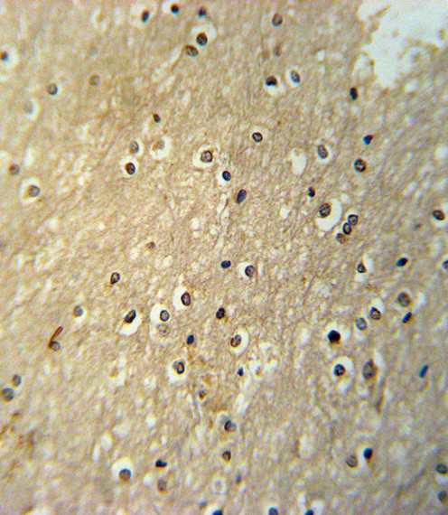 PAX6 Antibody in Immunohistochemistry (Paraffin) (IHC (P))