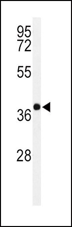 PAX6 Antibody in Western Blot (WB)