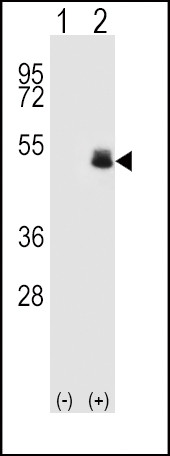 PAX6 Antibody in Western Blot (WB)