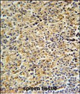 HCK Antibody in Immunohistochemistry (Paraffin) (IHC (P))