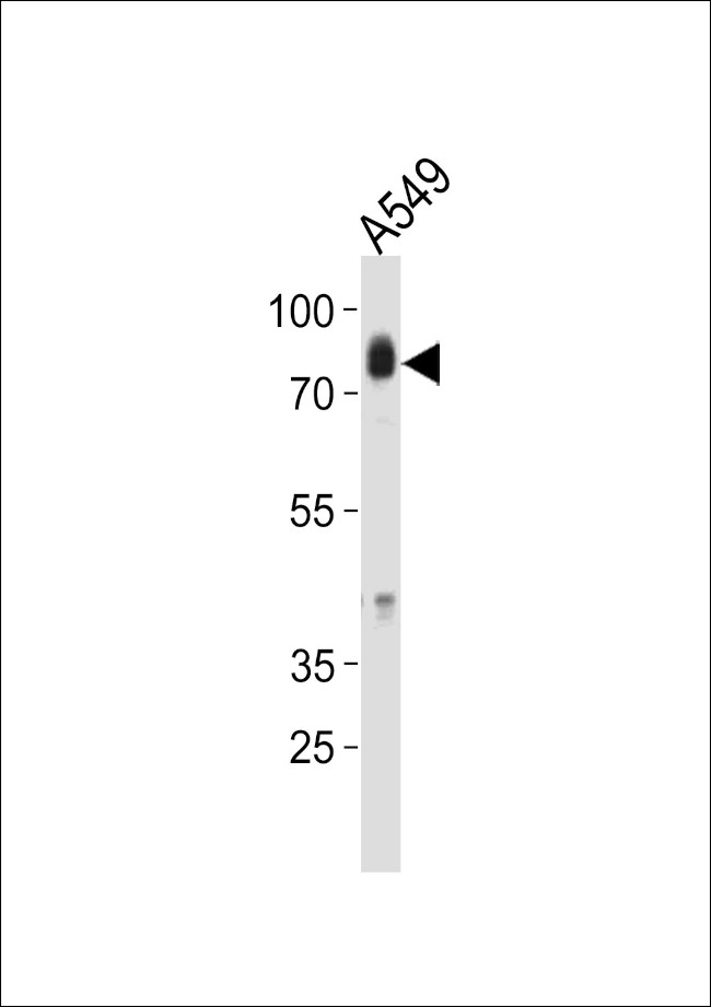 HCK Antibody in Western Blot (WB)