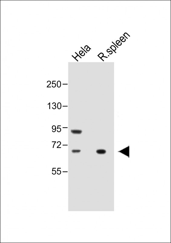 ALOX12 Antibody in Western Blot (WB)