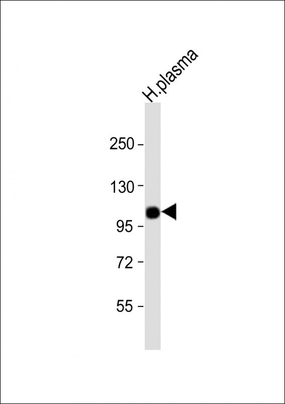 Complement Factor B Antibody in Western Blot (WB)