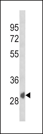 SFRP1 Antibody in Western Blot (WB)