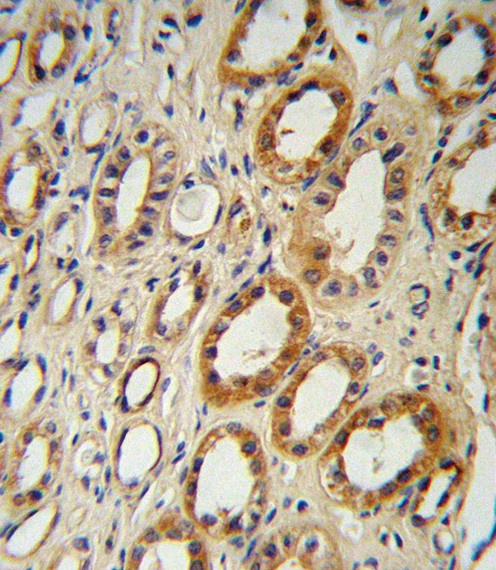 CYP27B1 Antibody in Immunohistochemistry (Paraffin) (IHC (P))