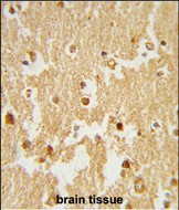 ESRRB Antibody in Immunohistochemistry (Paraffin) (IHC (P))