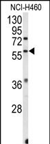 ESRRB Antibody in Western Blot (WB)