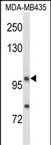 Neuropilin 1 Antibody in Western Blot (WB)