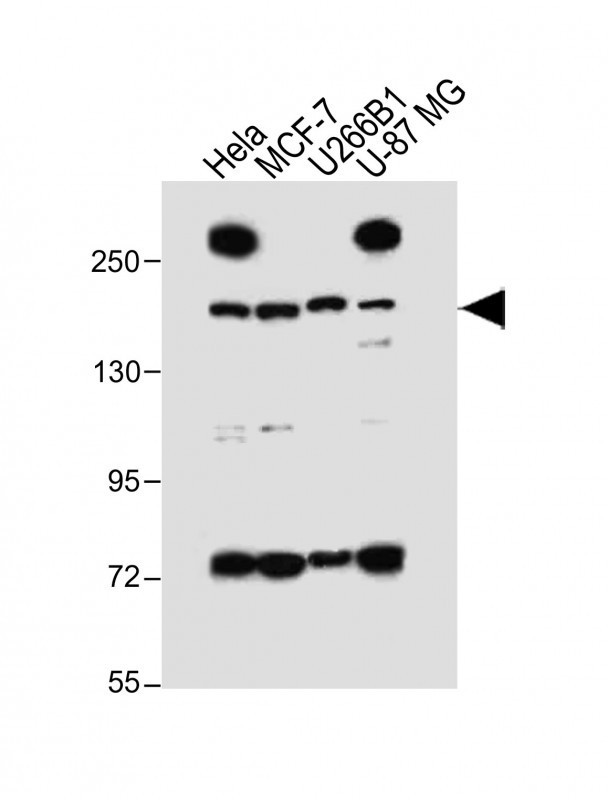 UTY Antibody in Western Blot (WB)